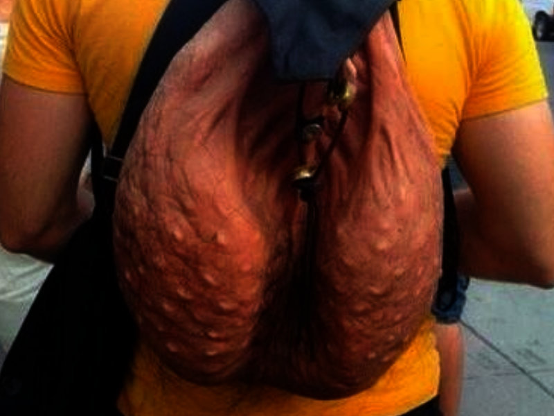 sac peau testicules