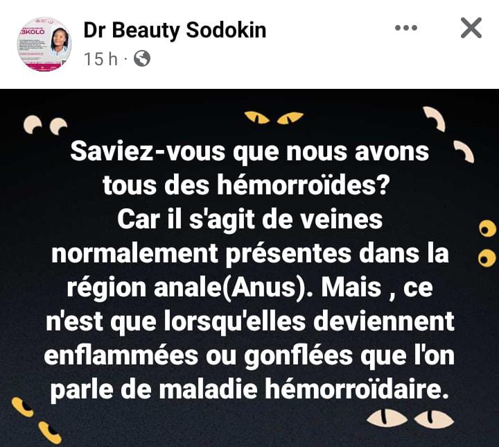 hémorroïdes