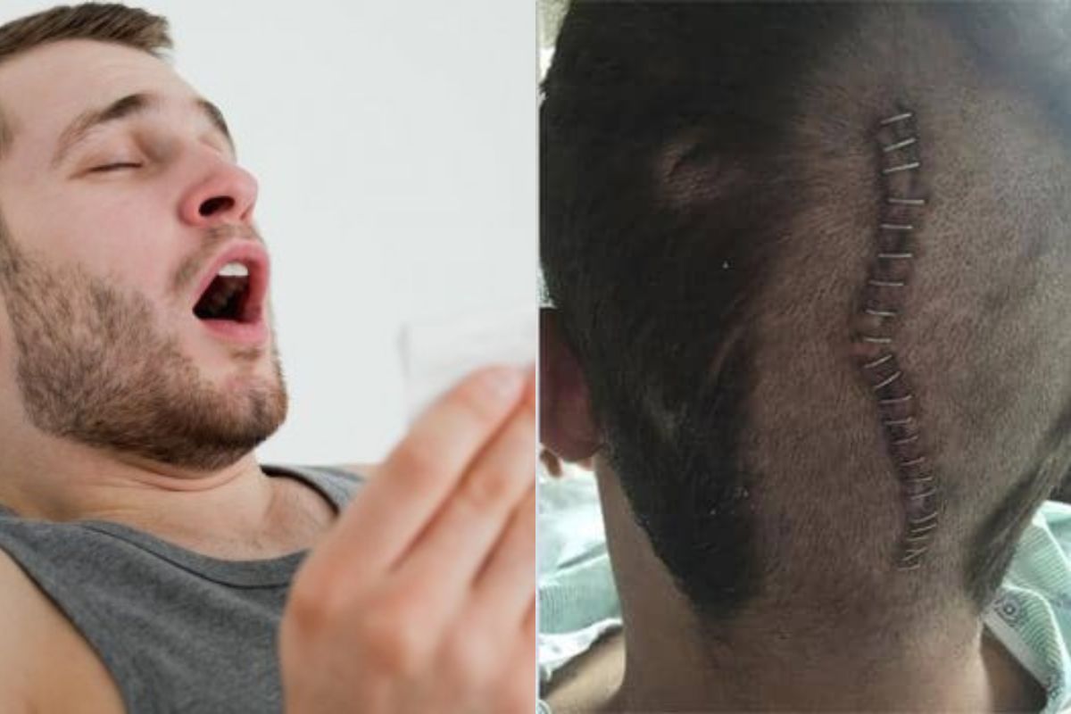 éternuement fait exploser cerveau