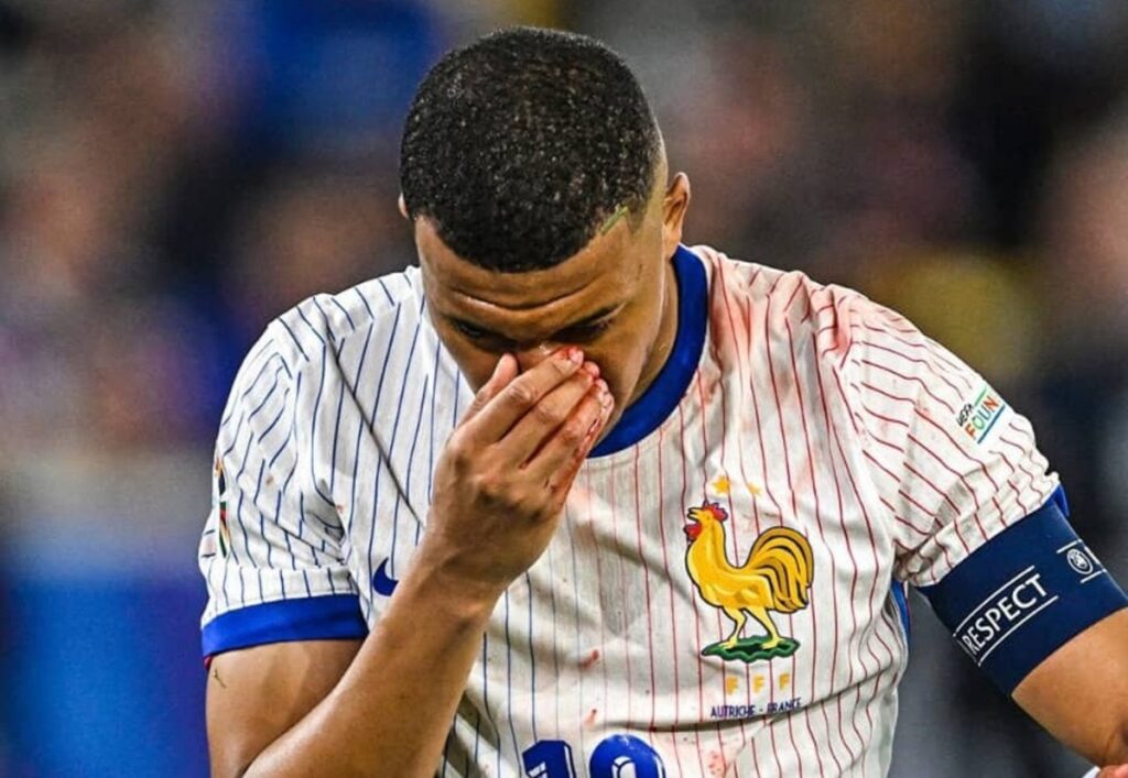 Gros coup dur pour la France : Kylian Mbappé aurait …