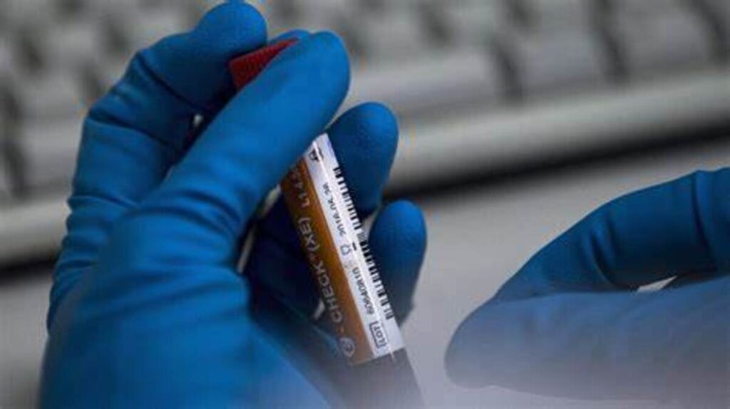 JO Paris / Sprint : un athlète africain positif à un test d’antidopage