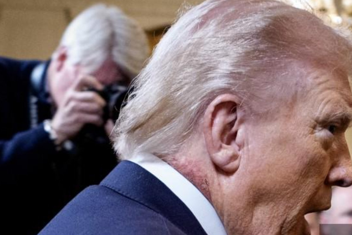 Donald Trump cou
